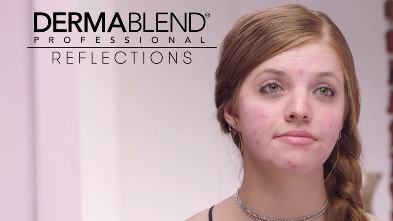 Thumbnail for Reflections: Mackenzie